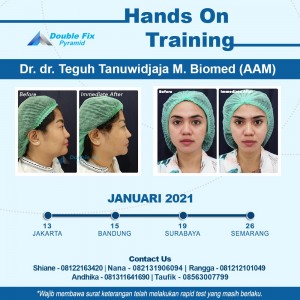 Double Fix Pyramid Training - January